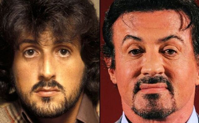 Before-And-After Celebrity Plastic Surgery Disasters