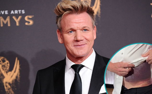 Gordon Ramsay's Message After Bike Crash: Wear a Helmet