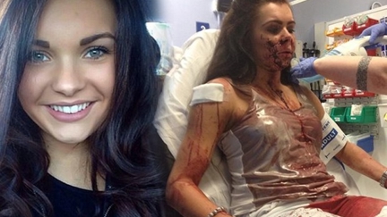 Woman Left Unable To Smile After Road Rage Attack