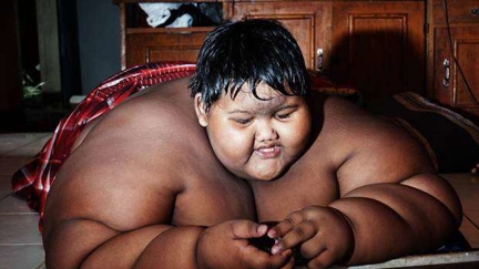 World's biggest child shows off INCREDIBLE transformation after losing over half his body weight!